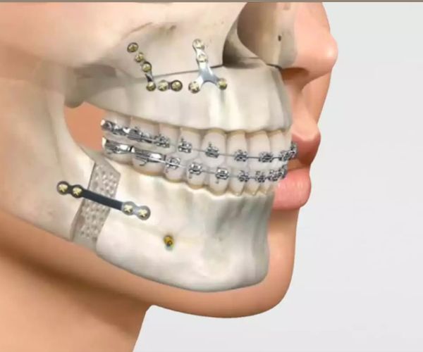 Cirugía Maxilofacial en Roldán