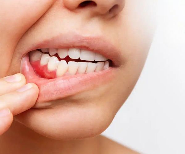 Periodoncia en Roldán